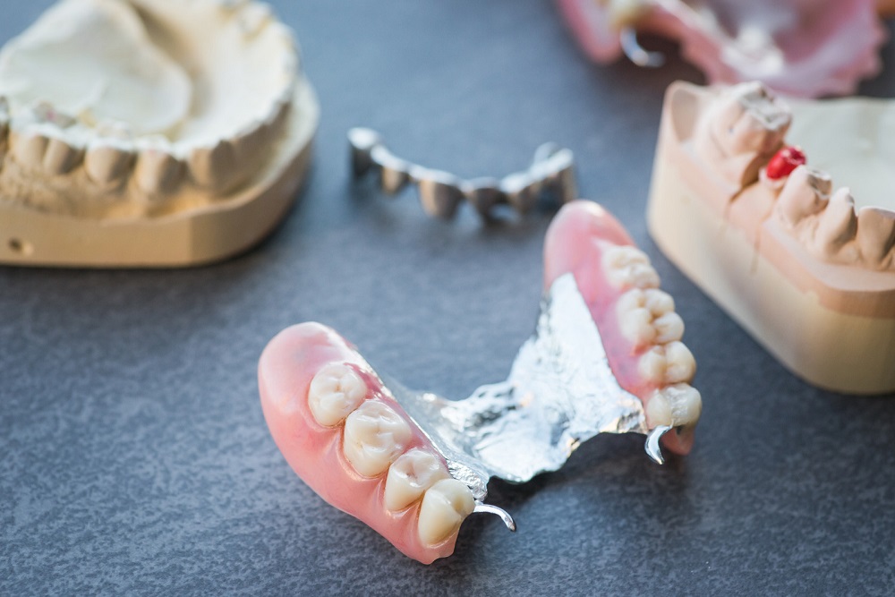 signs that indicate you need denture repairs